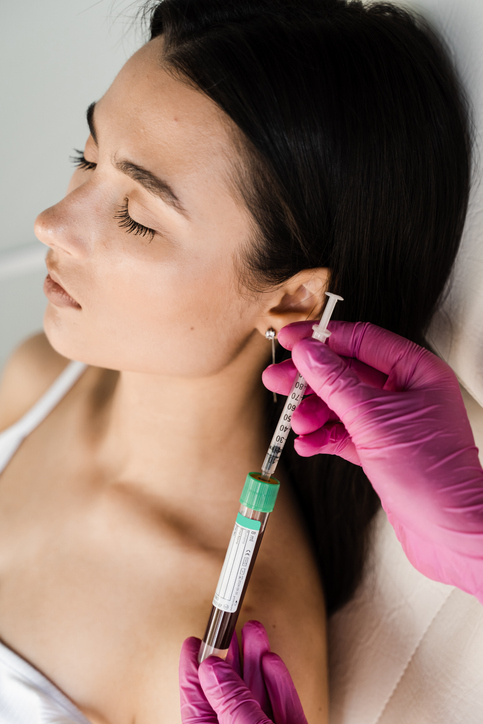 Cosmetologist with test tube with blood and plasma for PRP Platelet Rich Plasma procedure. Platelet Rich Plasma PRP for improves skin volume and texture, reduces flaccidity and fine wrinkles.