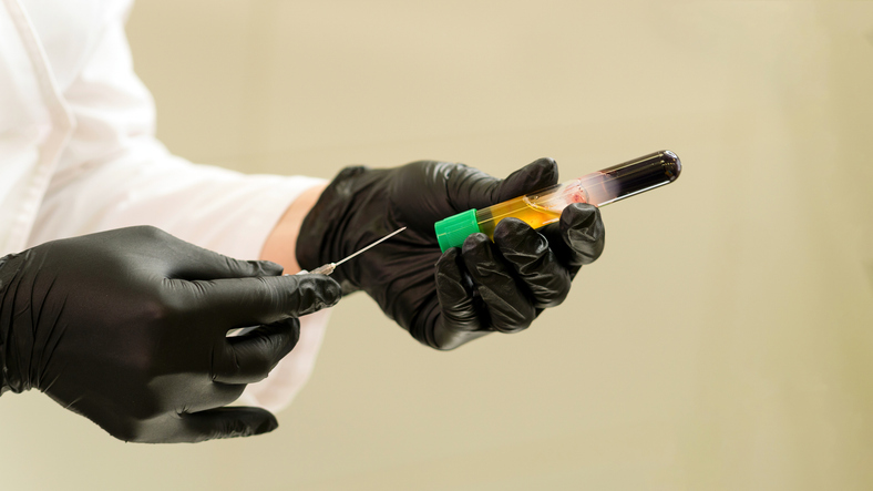 Platelet-Rich Plasma for injection